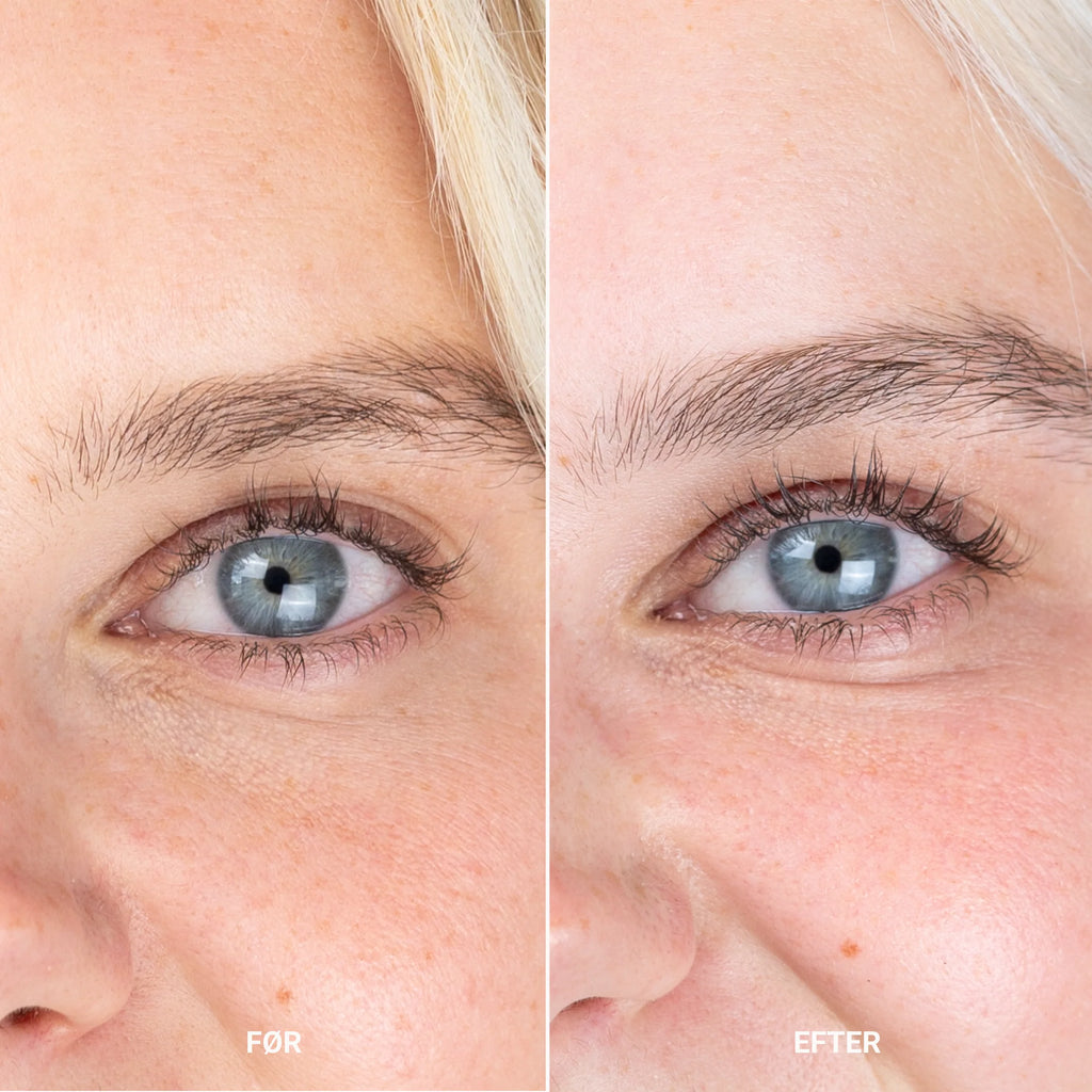 Eye Zone Conditioner