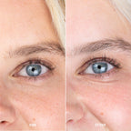 Eye Zone Conditioner