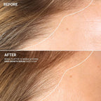 Hair Growth Serum