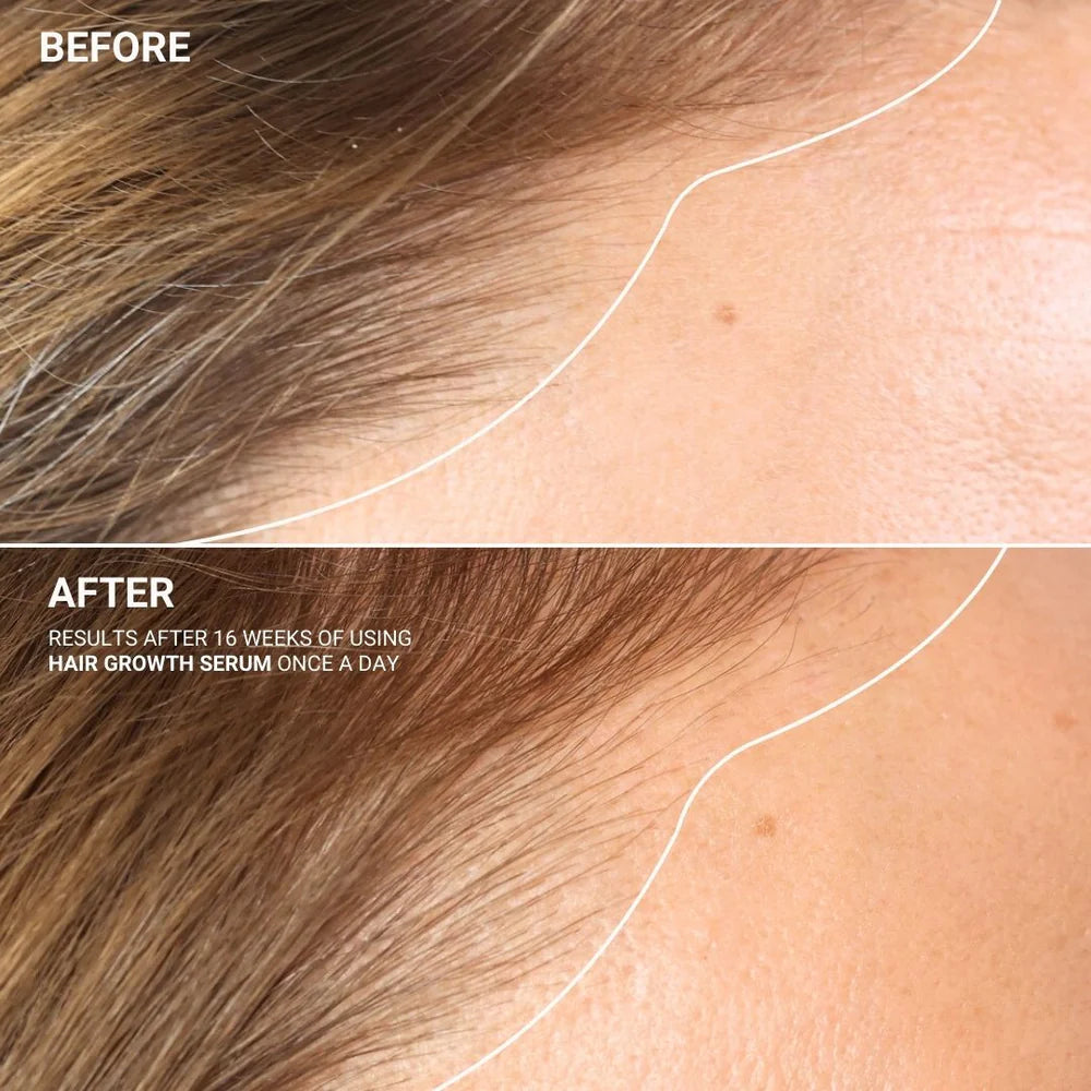 Hair Growth Serum