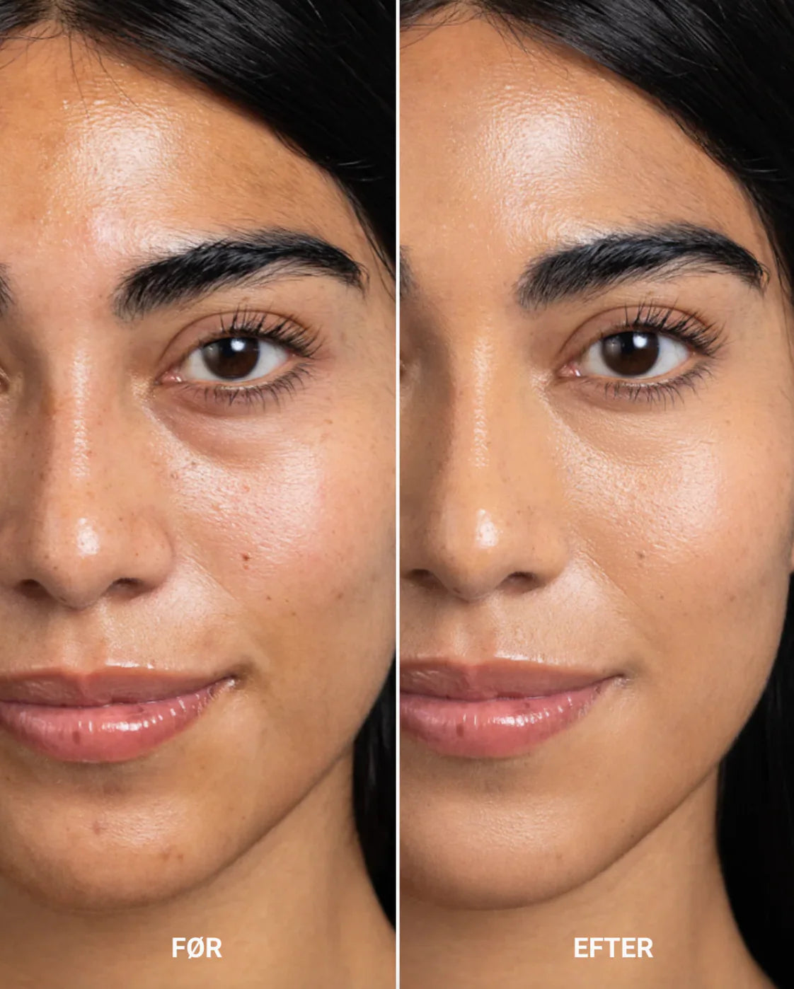 Perfecting Concealer - Medium Neutral Warm Golden