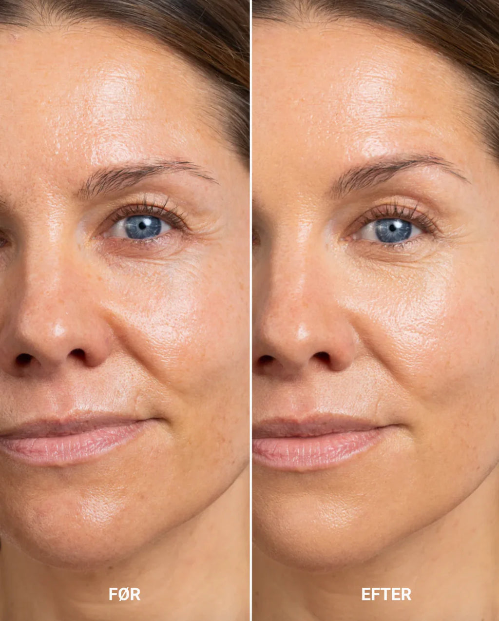 Perfecting Concealer - Light/Medium Neutral Golden