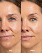 Perfecting Concealer - Light/Medium Neutral Golden