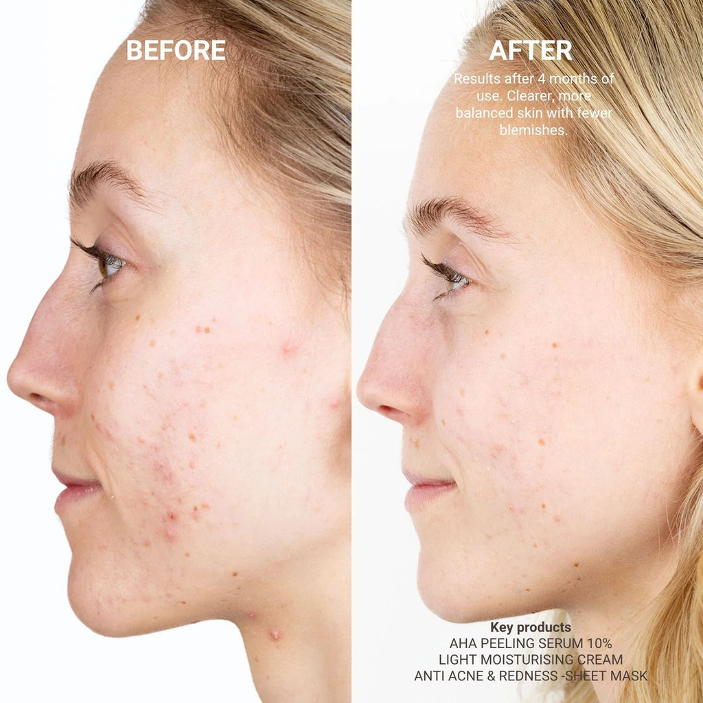 AHA Peeling Serum