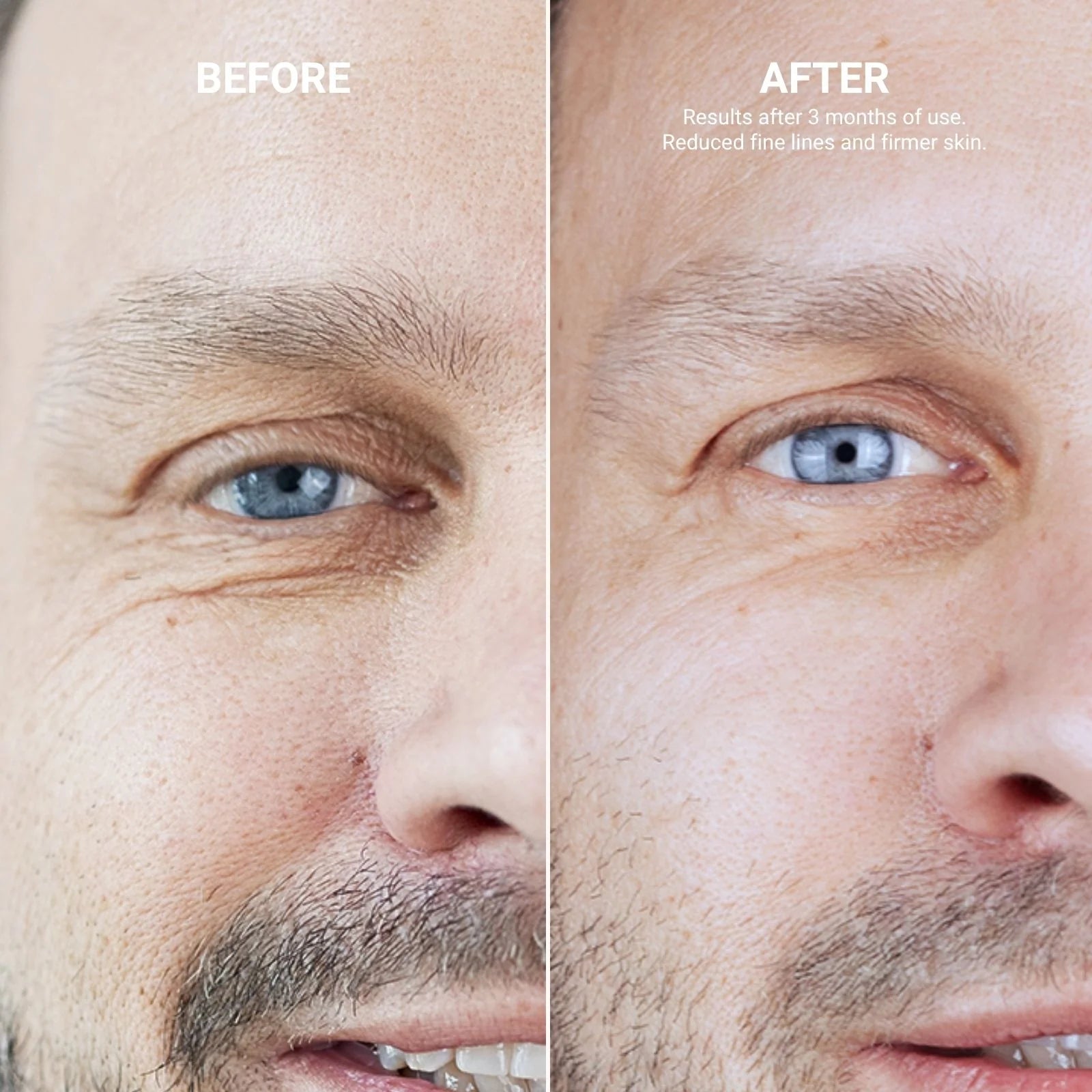 Refreshing Eye Cream