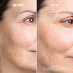 Cell Renewal Bakuchiol Cream